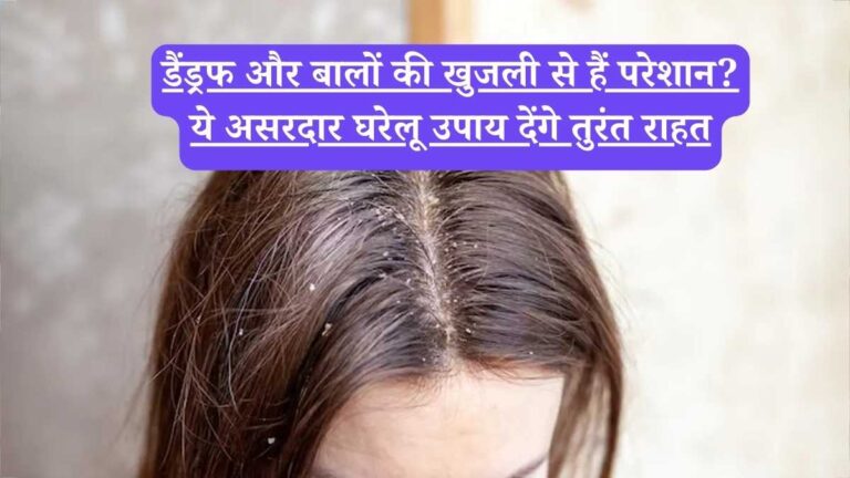 Home remedies for itchy scalp: डैंड्रफ और बालों की खुजली से हैं परेशान? ये असरदार घरेलू उपाय देंगे तुरंत राहत