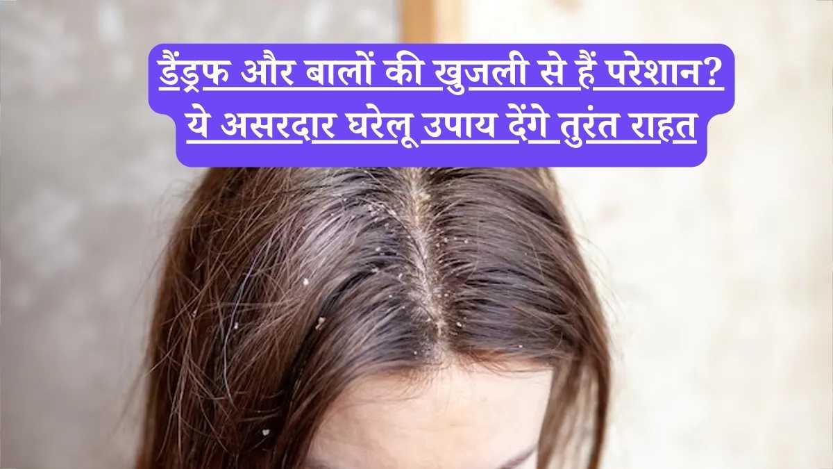Home remedies for itchy scalp: डैंड्रफ और बालों की खुजली से हैं परेशान? ये असरदार घरेलू उपाय देंगे तुरंत राहत